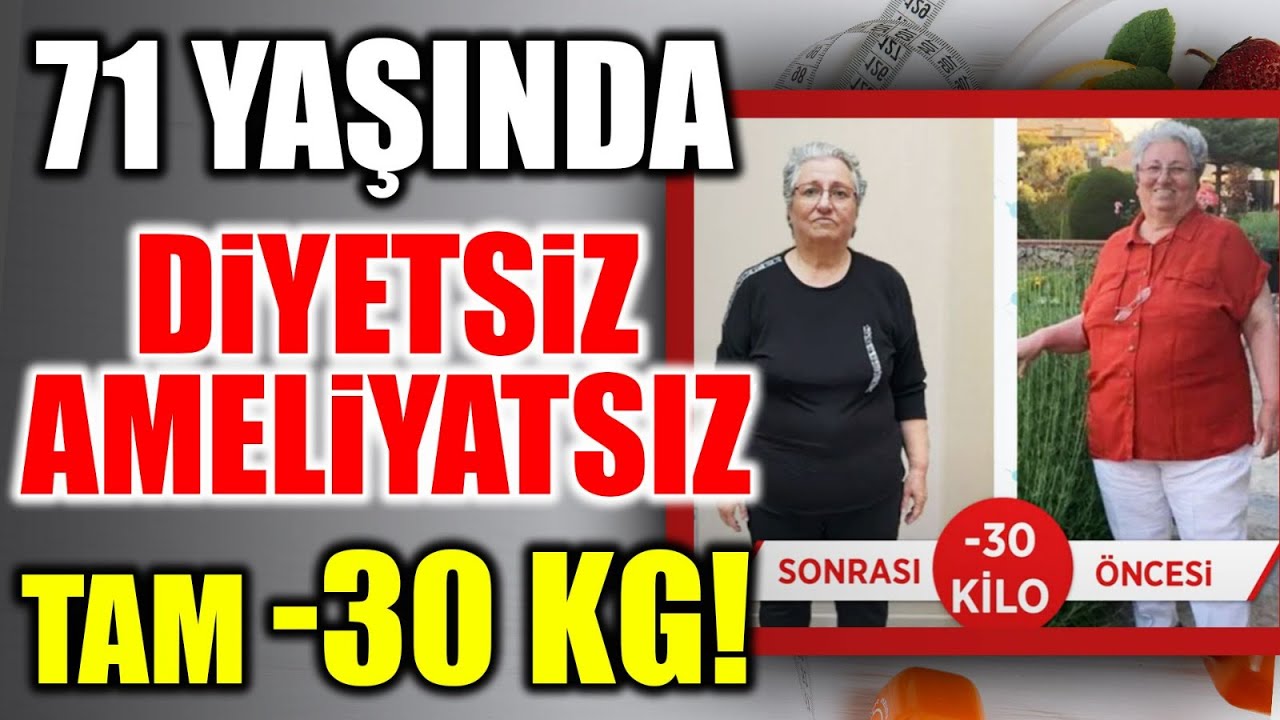 71 Yaşında Tam 30 Kilo Verdi! Gülay Hanım'ın Diyetsiz Ameliyatsız Kilo Verme Serüveni! Dr. Ayça Kaya