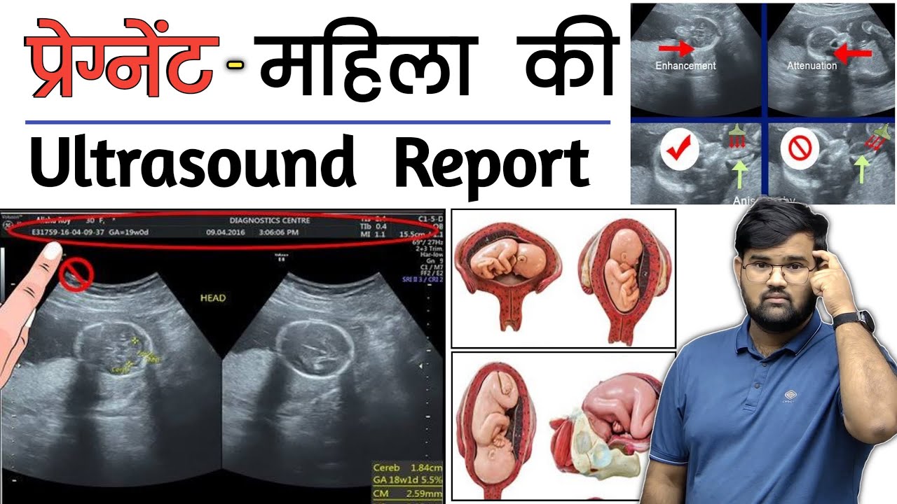 Pregnancy Ultrasound | Ultrasound Report | Medical | Doctor | MBBS | BHMS | BAMS | Nursing