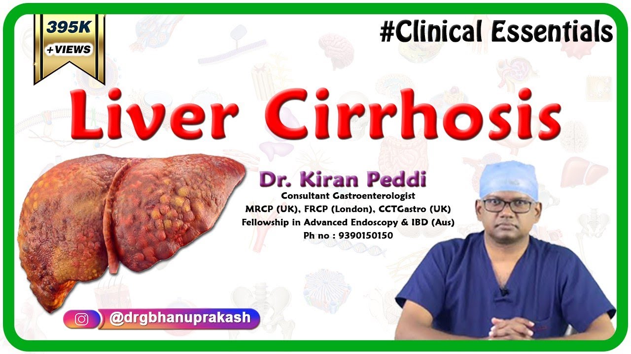 Liver Cirrhosis (Clinical essentials) - Dr. Kiran Peddi MRCP(UK), FRCP(London), CCT(Gastro)