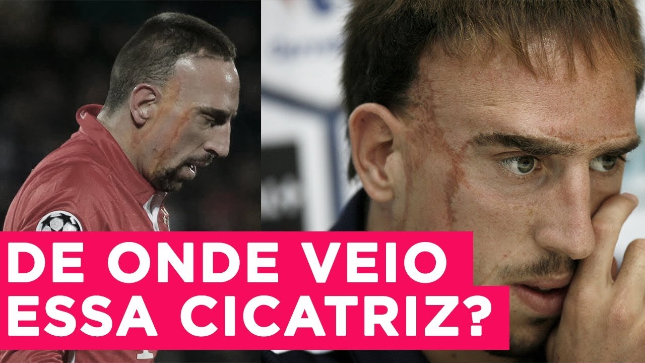 POR QUE RIBERY &Eacute; T&Atilde;O RESPEITADO NO FUTEBOL ALEM&Atilde;O | #RadarPELEJA 19