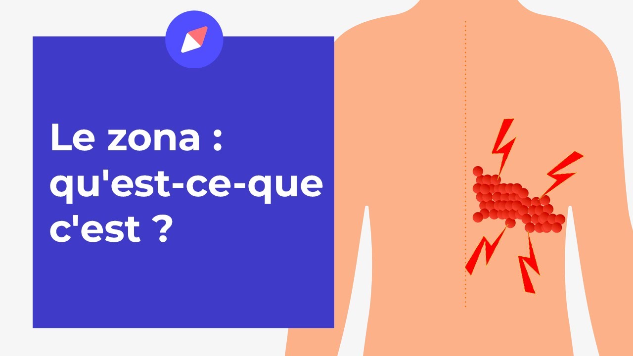 Zona : reconnaître les symptômes et le soulager