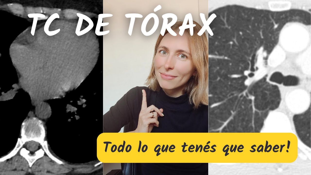 Tomografía computada de tórax ☢️ 🩺: ¡Todo lo que necesitas para empezar!