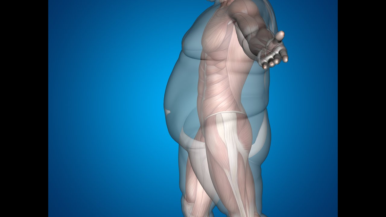 Review of Body Composition Testing Methods in NZ