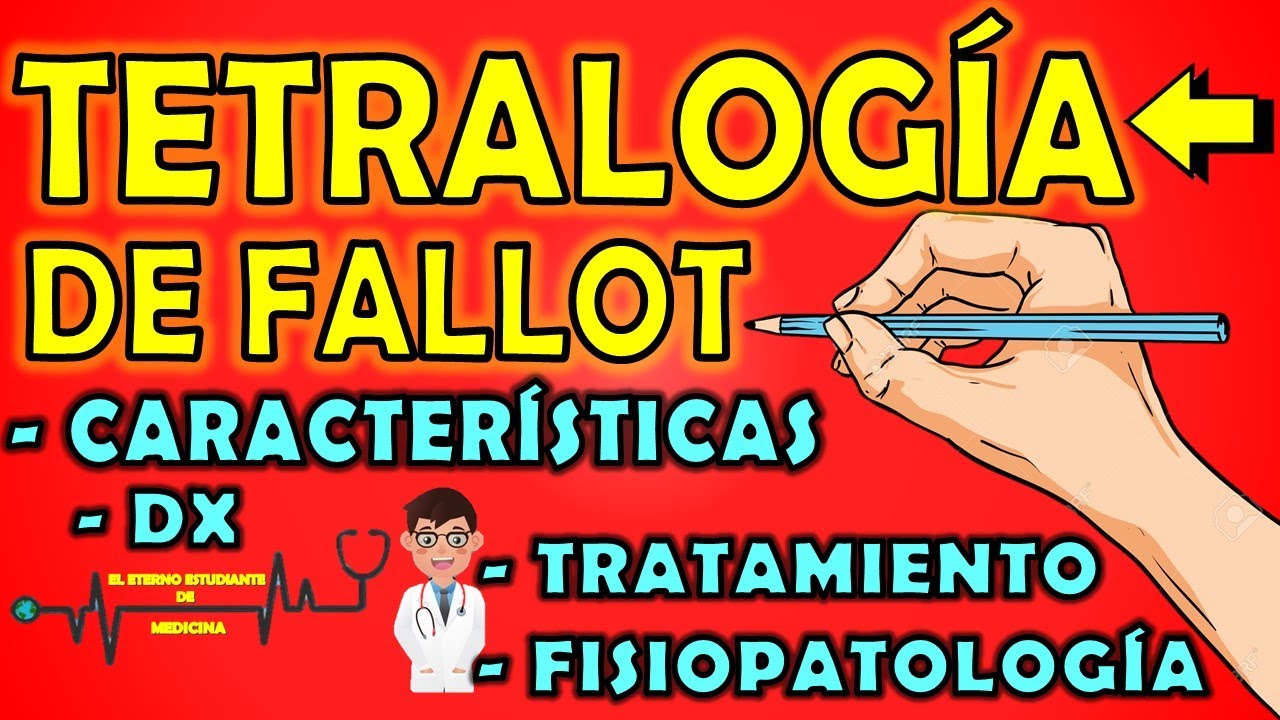 TETRALOG&Iacute;A DE FALLOT | Caracter&iacute;sticas, Fisiopatolog&iacute;a, Crisis Hip&oacute;xicas, Diagn&oacute;stico, Tratamiento 📝
