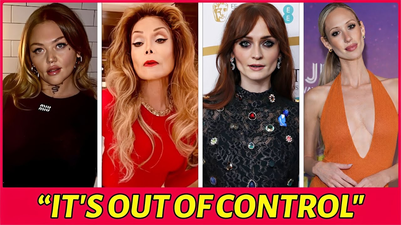 25 SHOCKING Stars Who Are Almost Unrecognizable After Ozempic