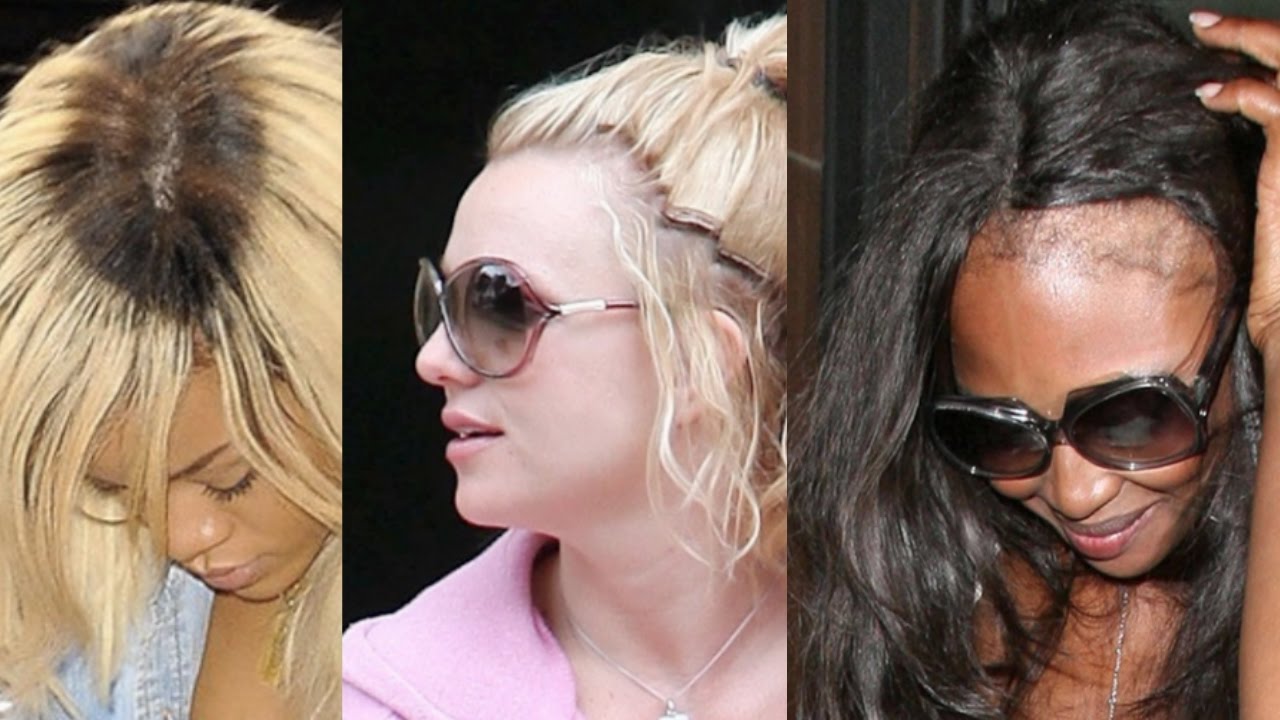 CELEBRITIES WHO WEAR WEAVE (Worst Hairstyles)
