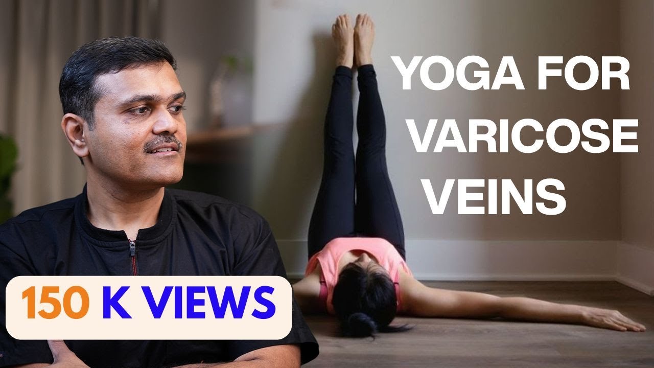 The Shocking Truth About YOGA and Varicose Veins Relief!