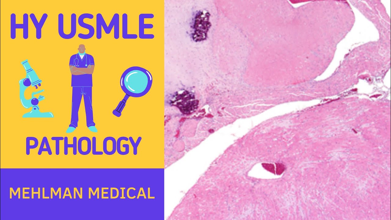 HY USMLE PATHOLOGY - # 246