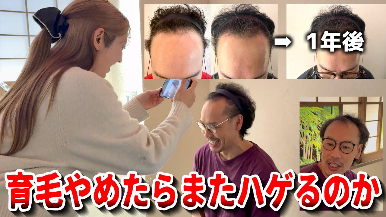 育毛で生えた毛たちは育毛辞めたらすぐに抜けて元に戻るのか？