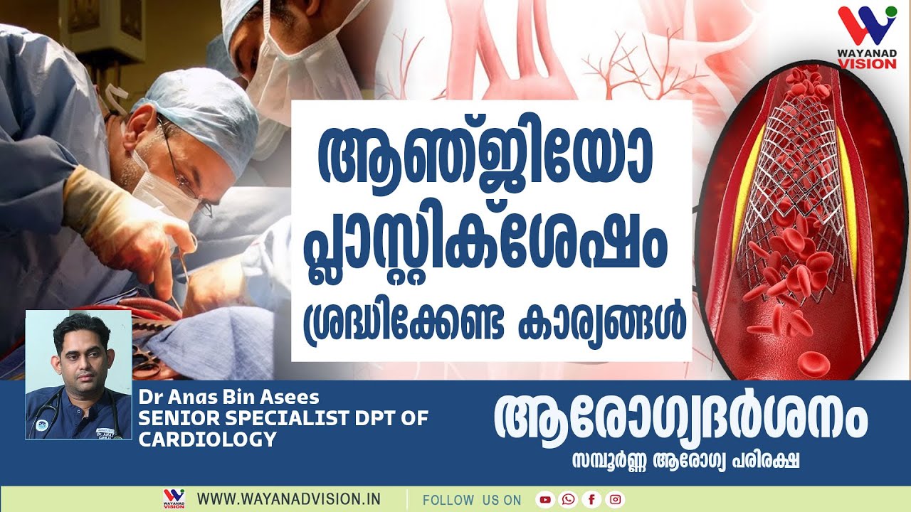 അഞ്ചിയോപ്ലാസ്റ്റിക്ക് ശേഷം ശ്രദ്ധിക്കേണ്ട കാര്യങ്ങള്‍
