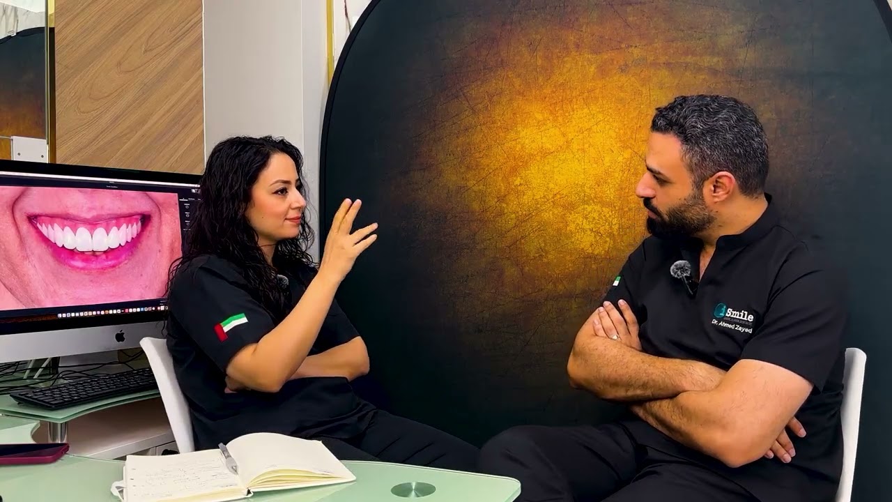 تعرف على أنواع الفينير وخطوات ابتسامة هوليود مع اي سمايل