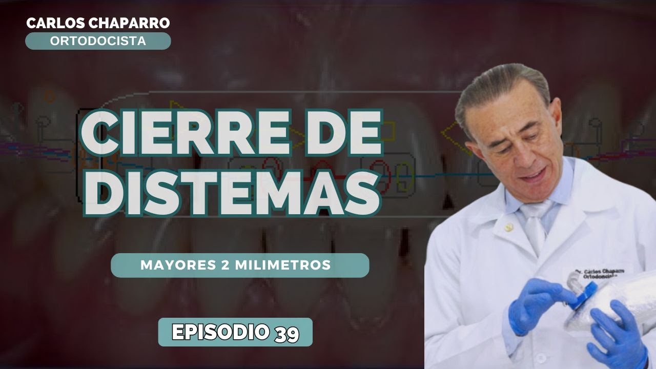 CIERRE DE DIASTEMAS MAYORES A 2MM - EPISODIO 39