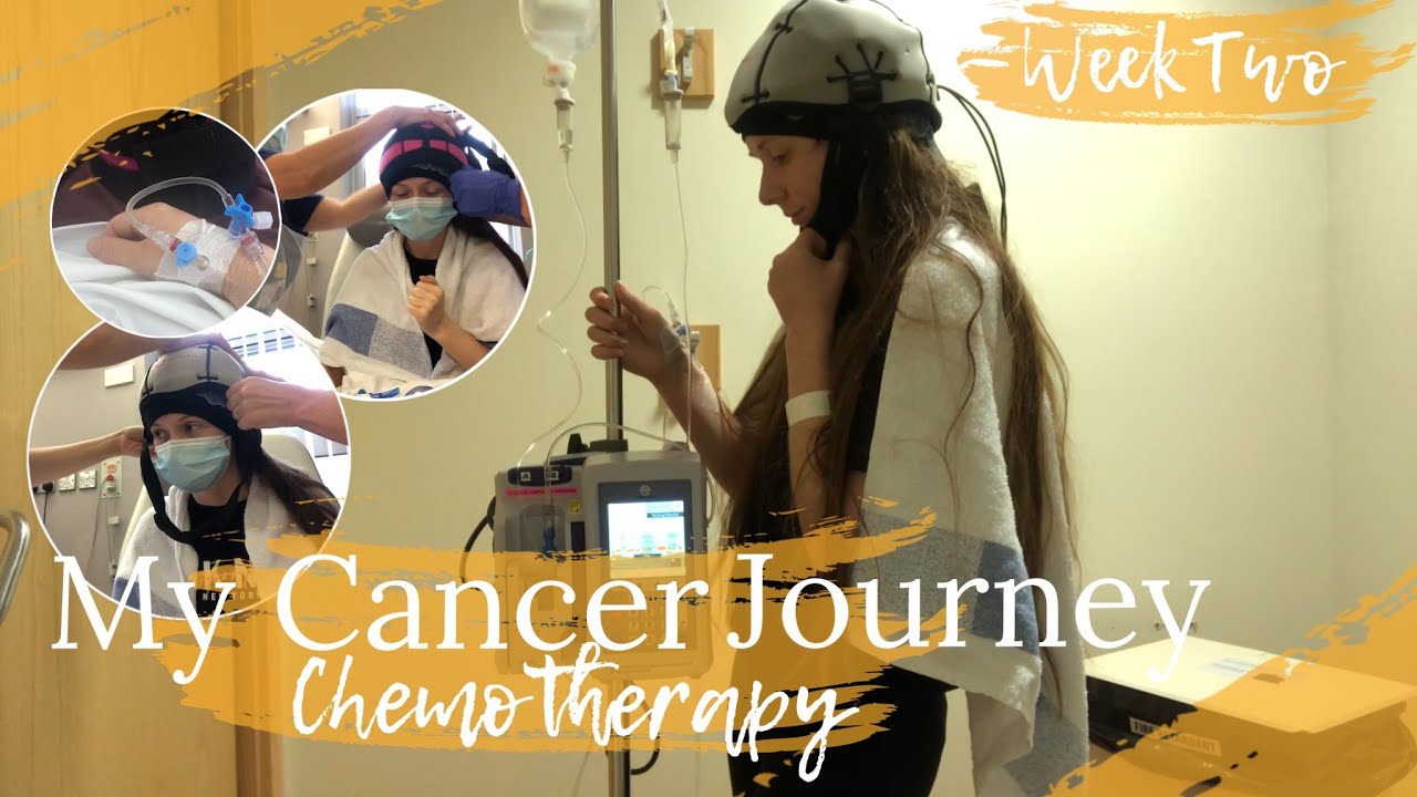 My Cancer Journey - My Second Chemotherapy (Week Two vlog) Cold Cap + Mini vlog
