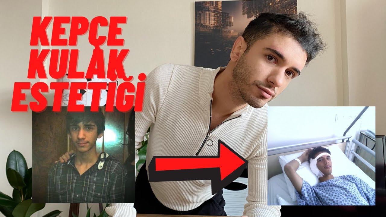MERHABA YOUTUBE, KEPÇE KULAK ESTETİĞİ (ÖNCESİ ve SONRASI-MALİYET?)