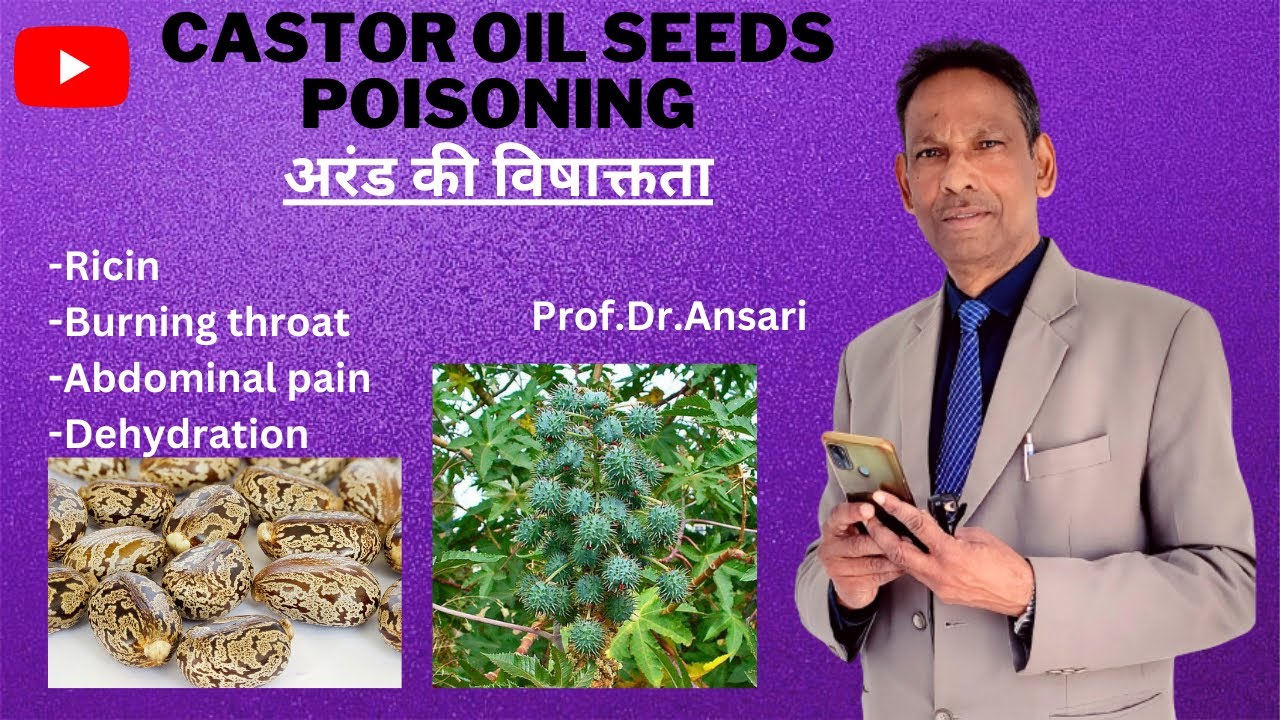 Castor oil seeds poisoning | Ricin | Burning throat | Abdominal pain | Dehydration | Toxicology