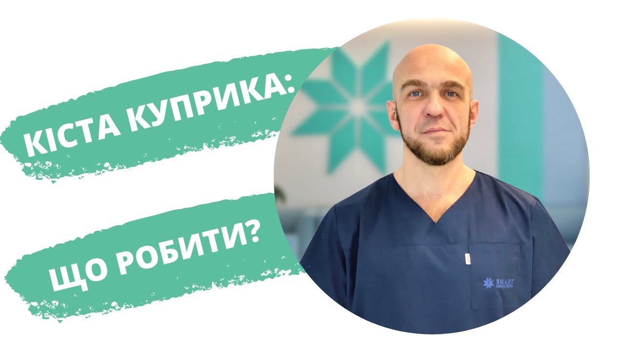 Кіста куприка: що робити?