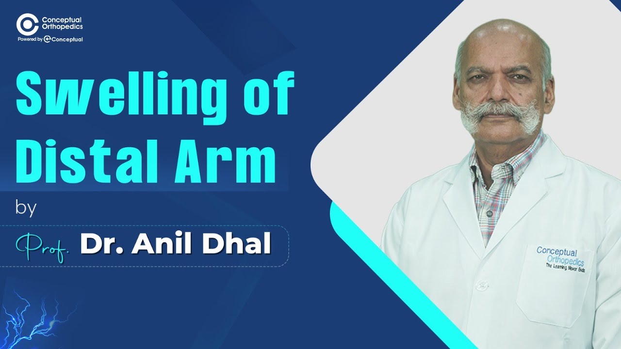 Short Interactive Case Swelling of Distal Arm by Dr Anil Dhal@ConceptualOrthopedics