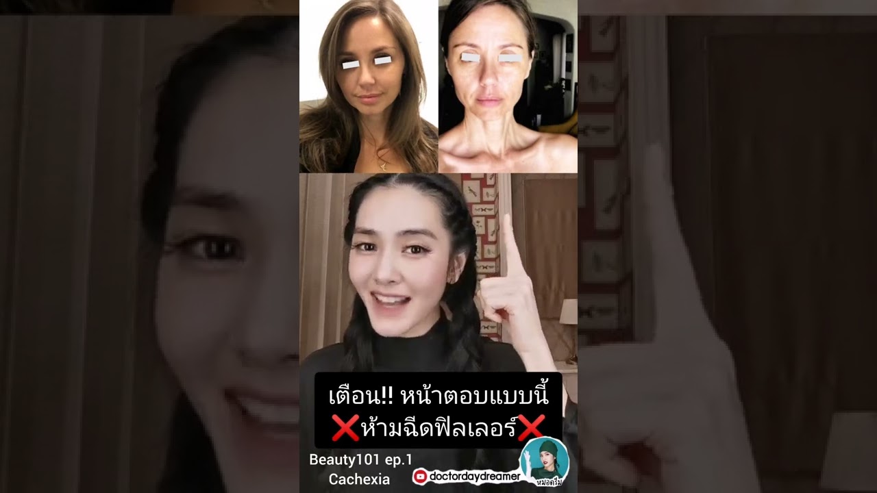เตือน!! #หน้าตอบ แบบนี้ห้ามฉีด #ฟิลเลอร์​ จนกว่าจะทำสิ่งนี้ #​BEAUTY101 ep.1 | DOCTOR DAYDREAMER
