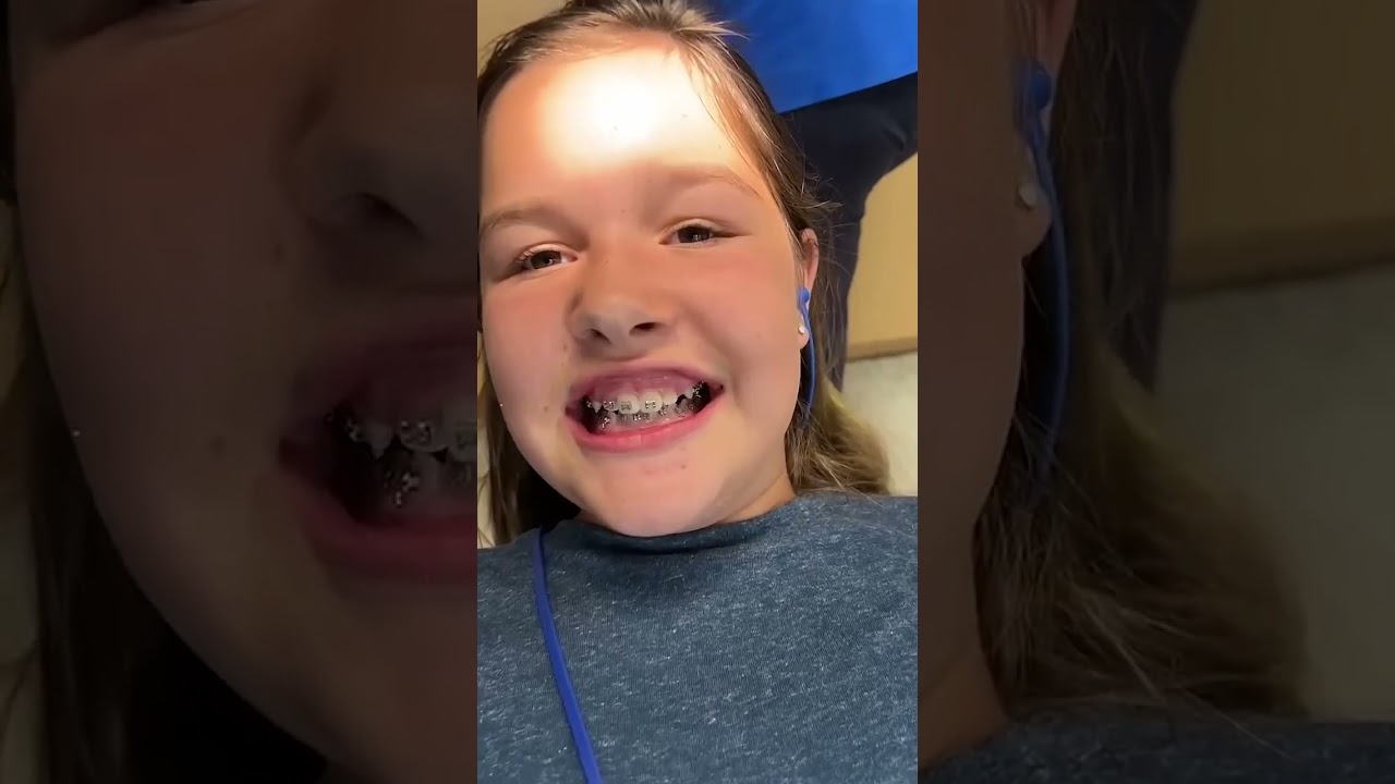 Braces #kidsfun #kidslearning