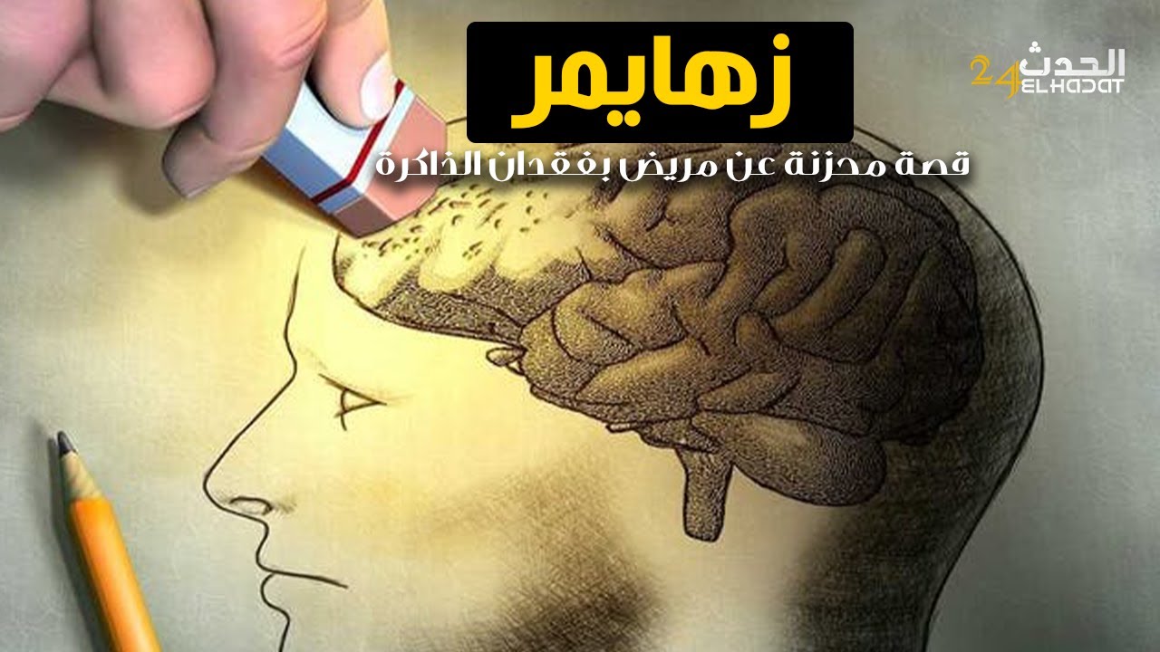 زهايمر.. قصة مؤثـ رة عن مريض فاقد للذاكرة