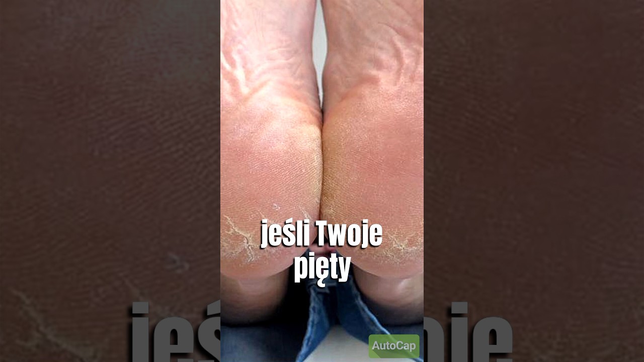 SPOS&Oacute;B NA SUCHE PIĘTY #shorts