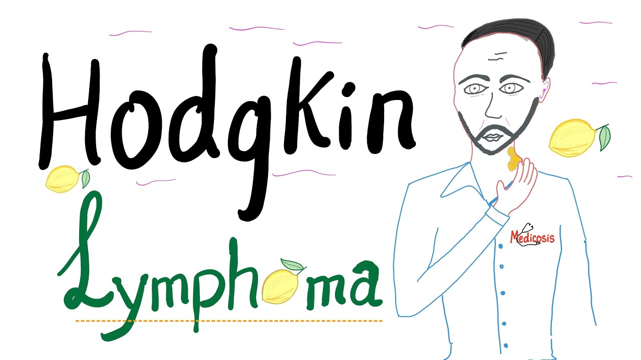Hodgkin’s lymphoma - Hodgkin’s Disease - Reed-Sternberg Cell - Hematology and Oncology