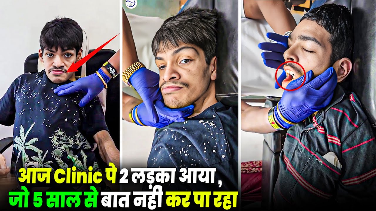 आज Clinic पे 2 लड़का आया , दोनों अपना नाम भी नहीं बोल पा रहा है || Scoliosis Treatment ||