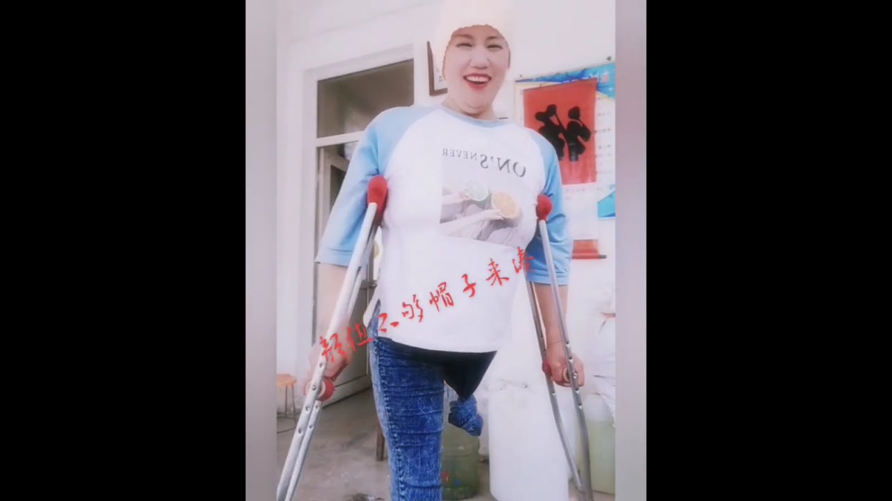 The beautiful woman is an amputee and lives with one leg, walking with crutches #amplife