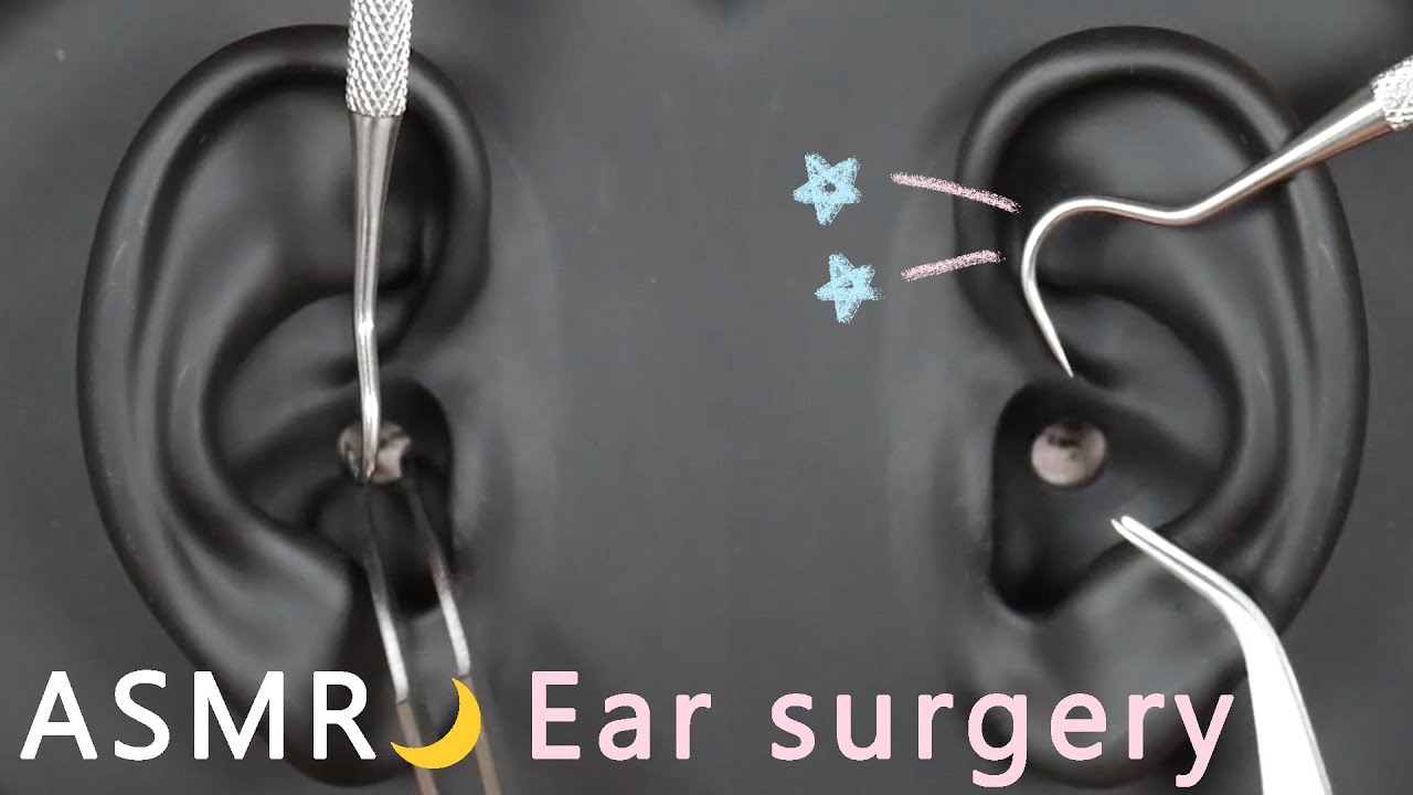 고막 귀수술 1시간!💤｜Ear surgery 1 hour ｜耳の手術1時間