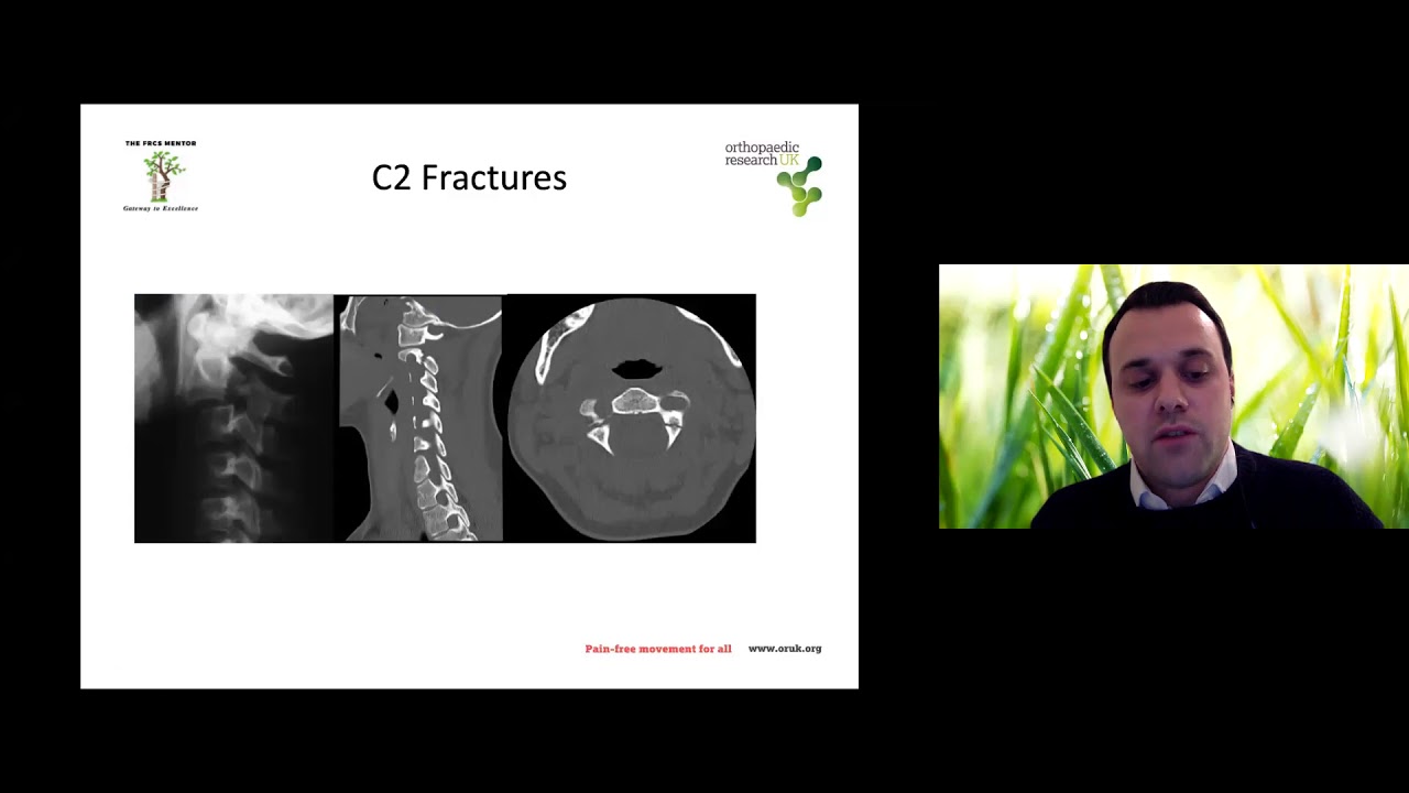 Cervical spine trauma