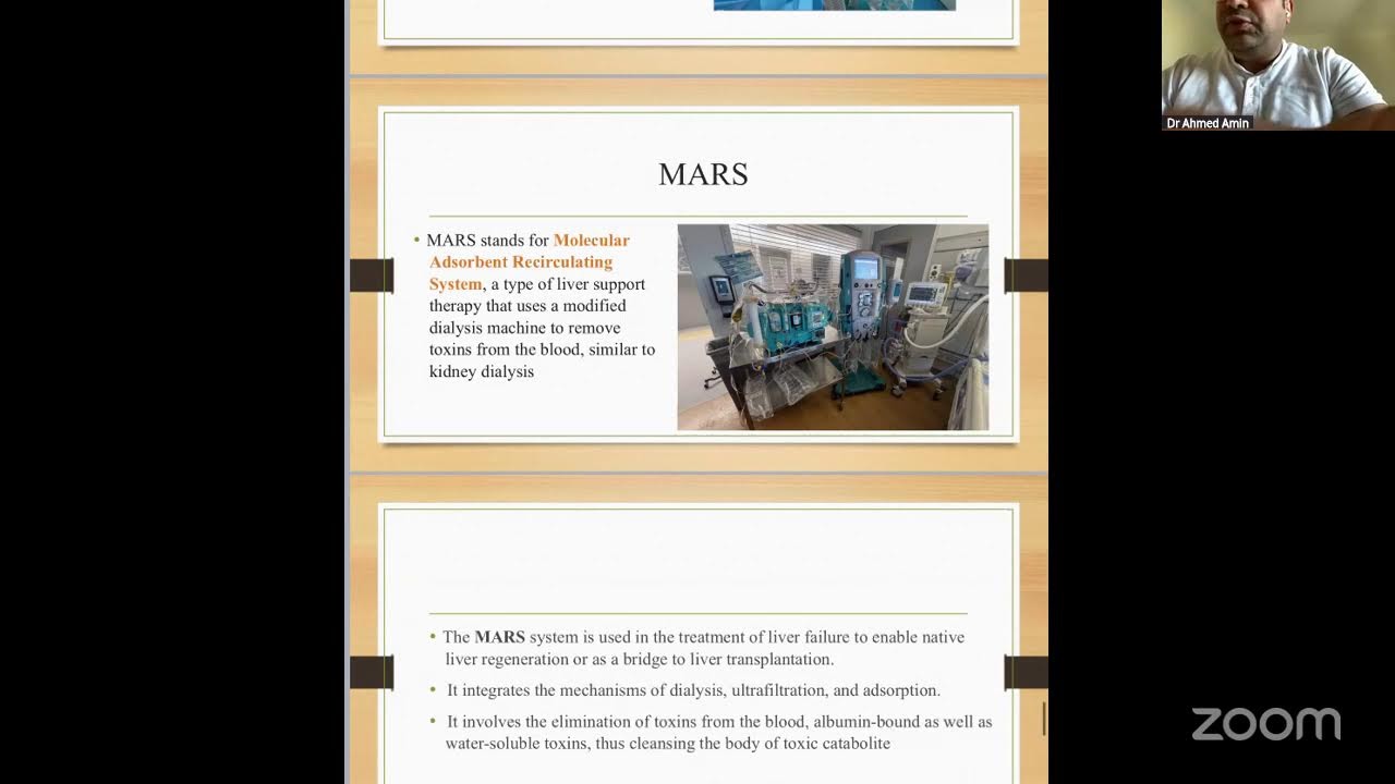 CRRT Dr Ahmed Amin PICU Wheel
