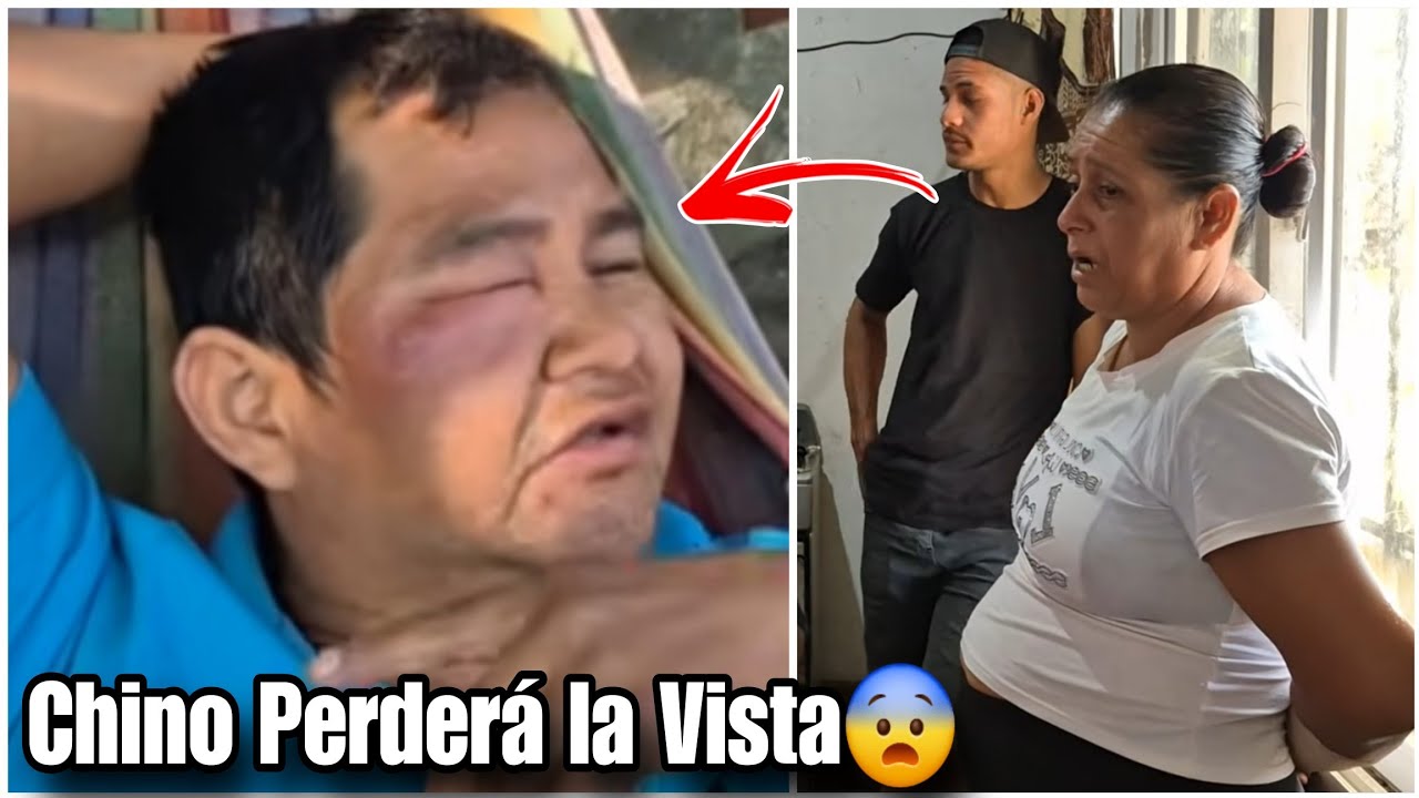 Urgente Chino le se Inchó la Cara de tanto que doña Judith y Darlyn lo Vrgea 😱