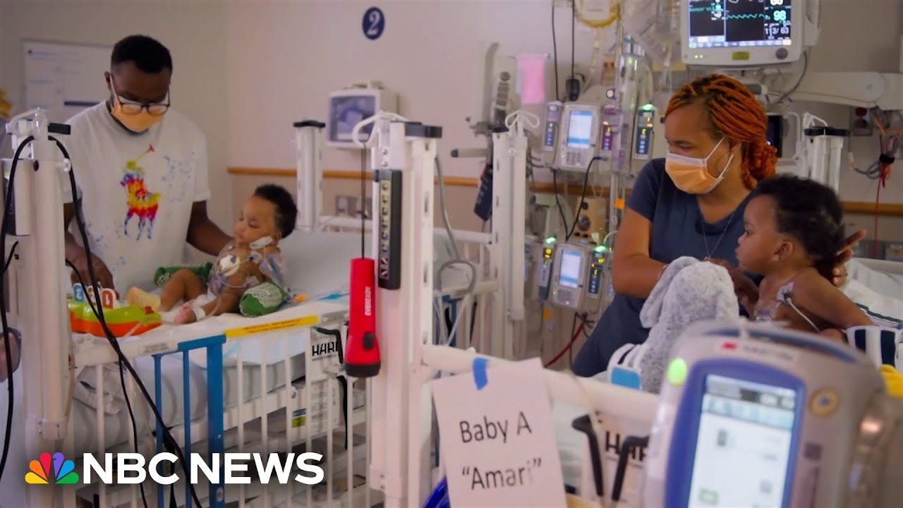 Surgeons in Philadelphia successfully separate conjoined twins