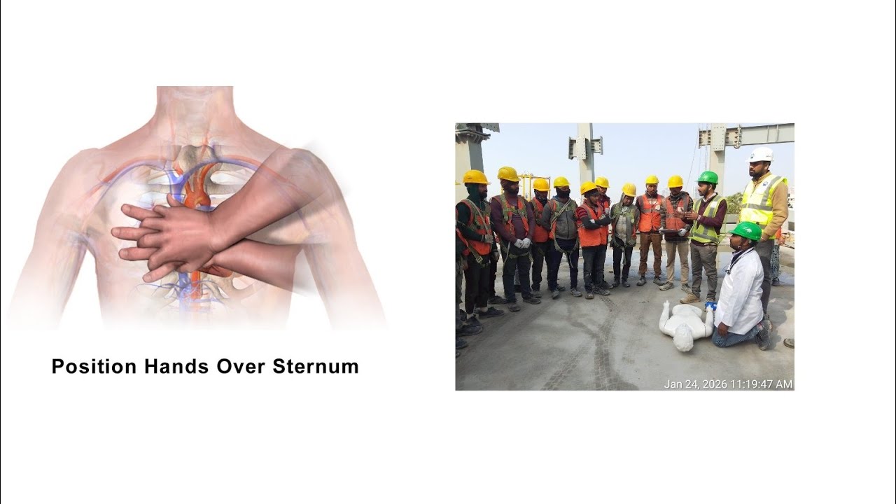 श्वसन प्रणाली क्रिया (CPR), Staff #Workers,  