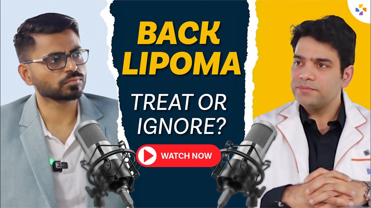 Ignore Back Lipoma? You Might Regret It! #lipomatreatment #lipoma #pristyncare