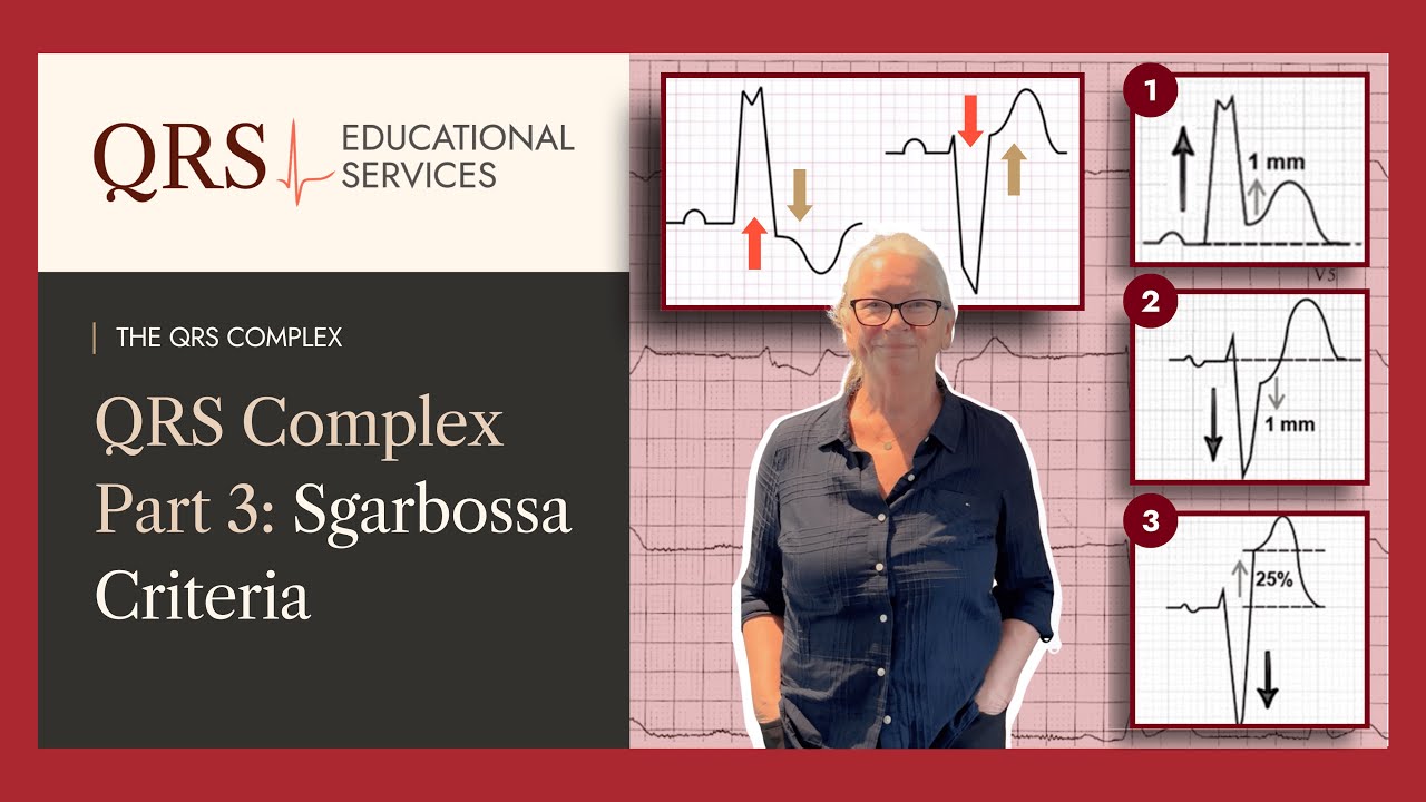 QRS TIPS: The QRS Complex Part 3 - Sgarbossa Criteria | QRS Educational Services