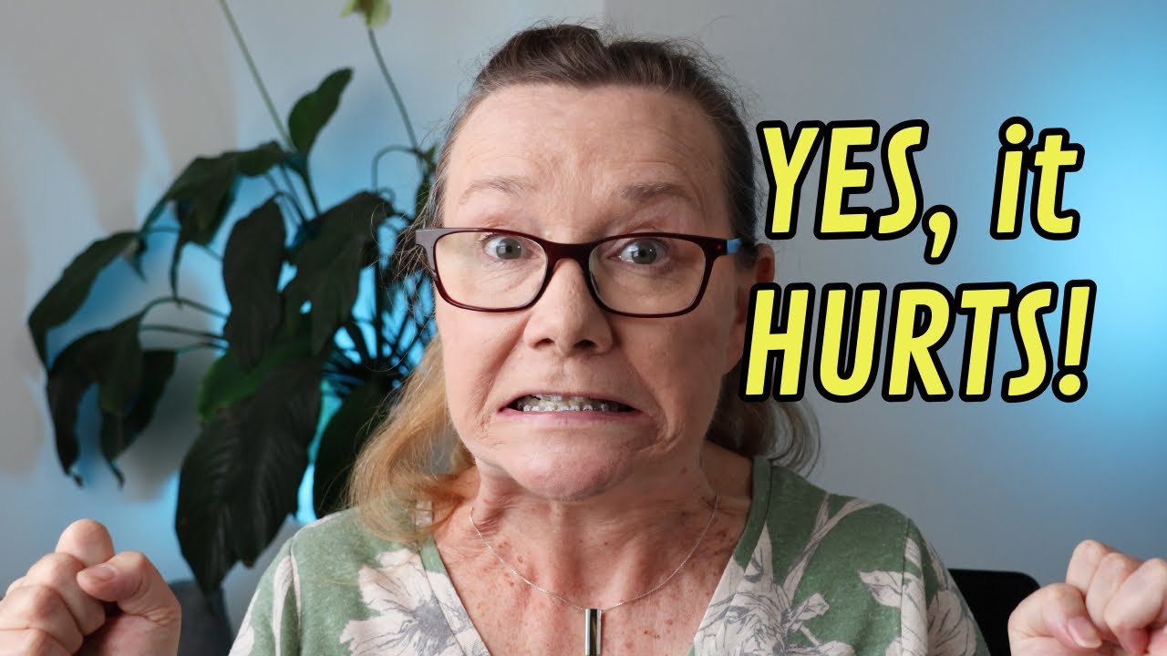 The HONEST Truth About Adult Braces!