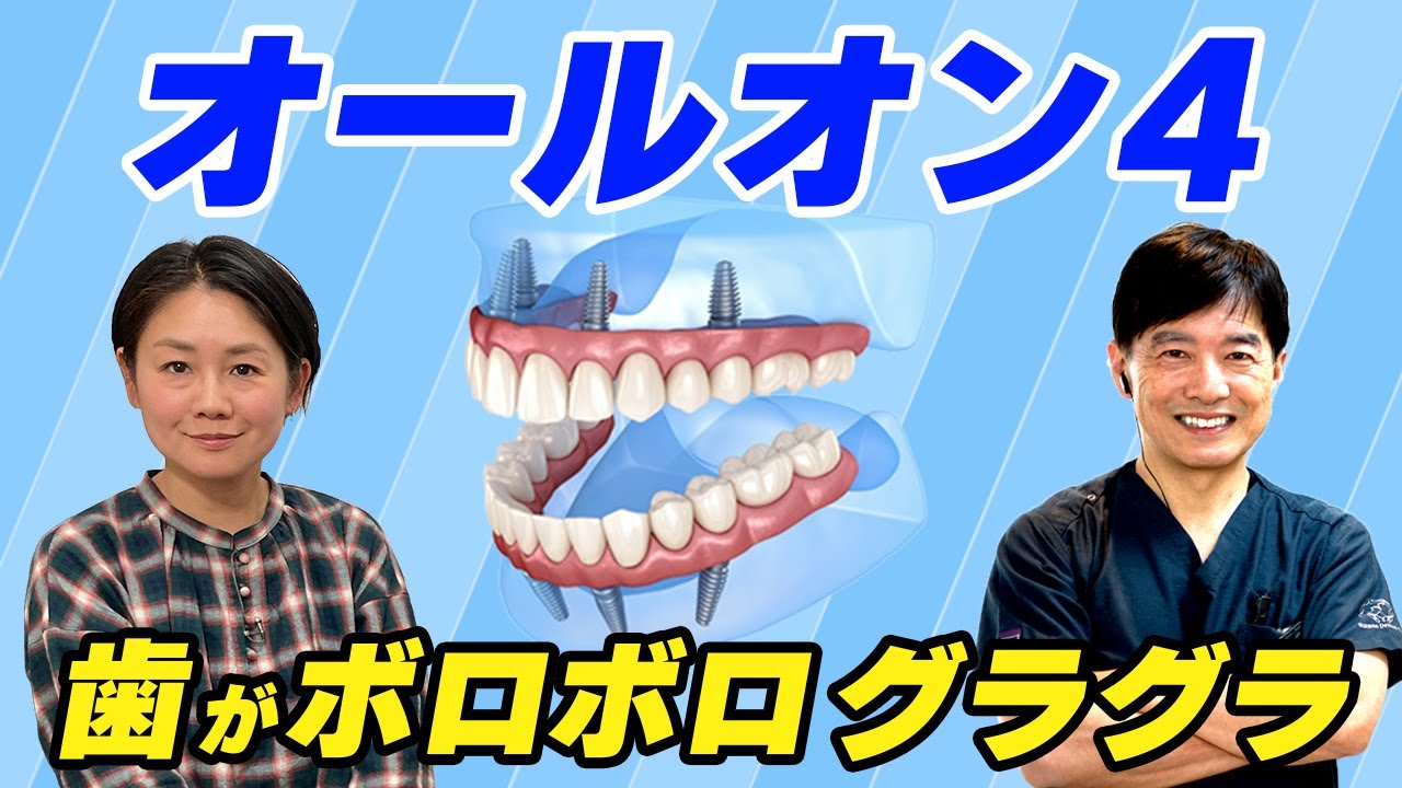 【オールオン４】歯がボロボロ・ガタガタな方が1日で歯を抜いてインプラントを入れて仮歯まで入るオールオン４とは？