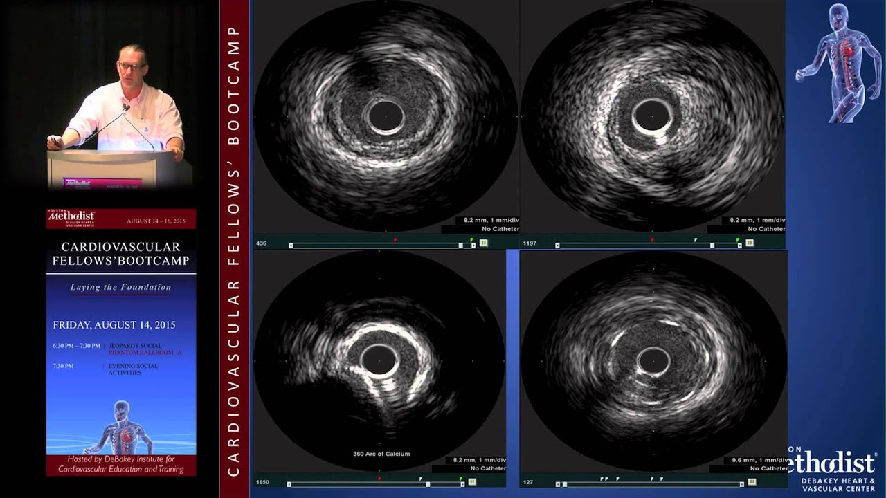 IVUS and FFR (Colin Barker, MD)
