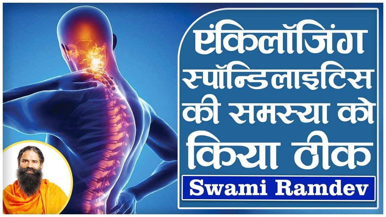 एंकिलॉजिंग स्पॉन्डिलाइटिस की समस्या को किया ठीक || Swami Ramdev