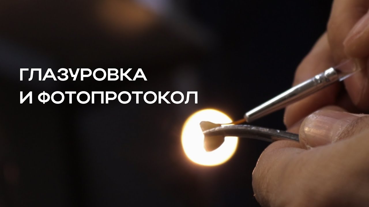 ГЛАЗУРОВКА: как работа с фотопротоколом влияет на результат