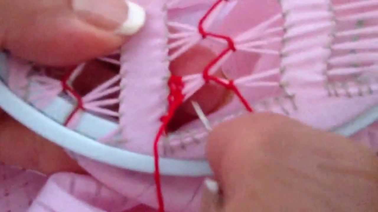 Desilado Tipo Zig Zag #2