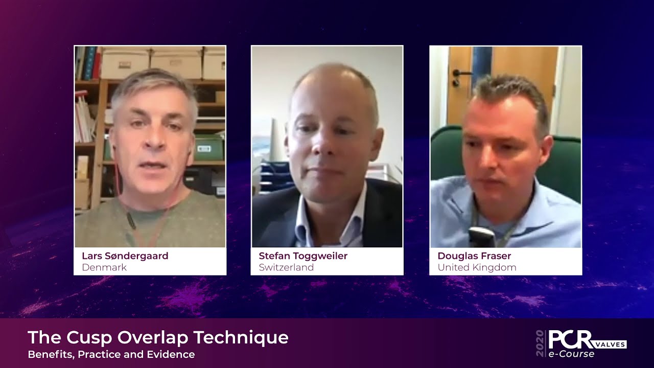 The Cusp Overlap Technique &ndash; Benefits, Practice and Evidence - PCR Valves e-Course 2020
