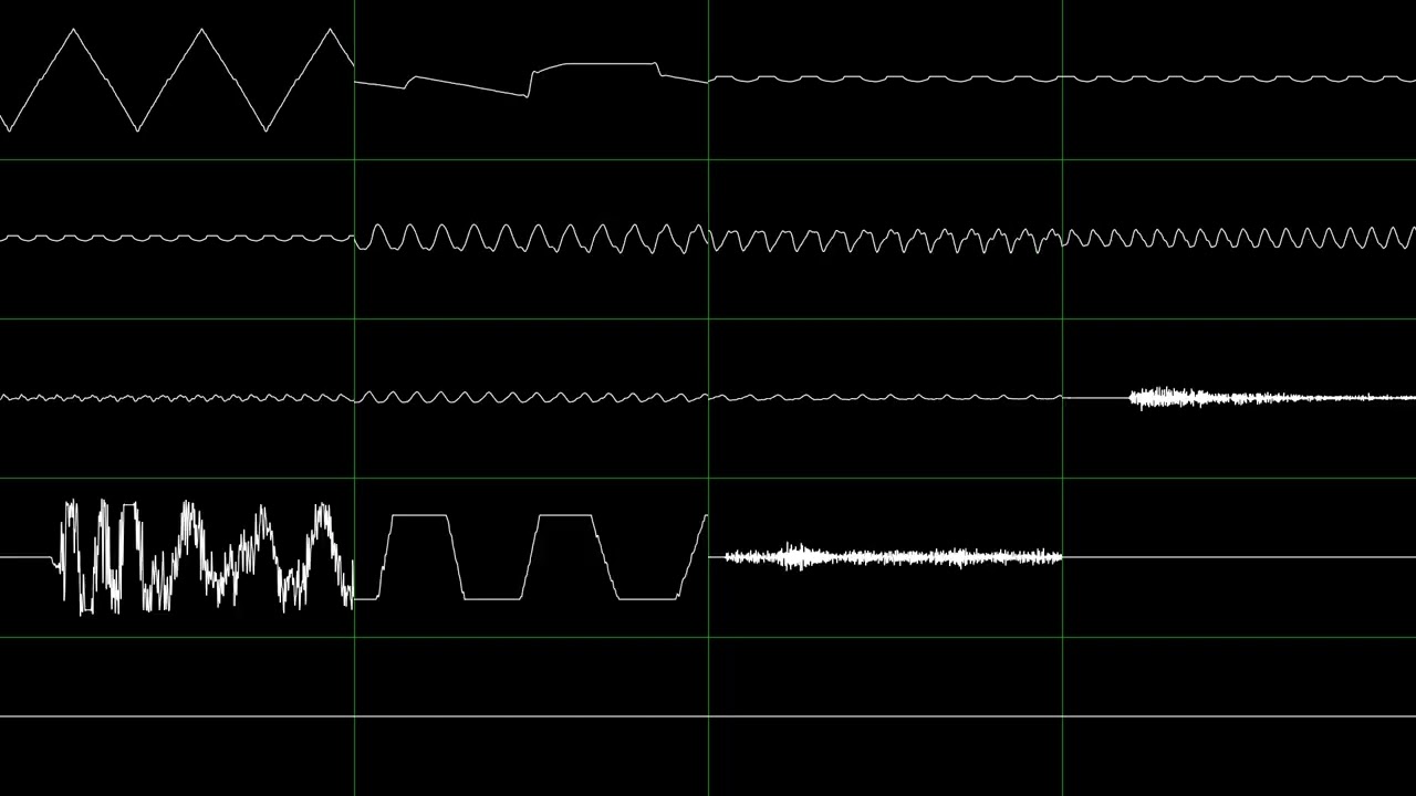 Have You Dreamed? (XM, 260KB)