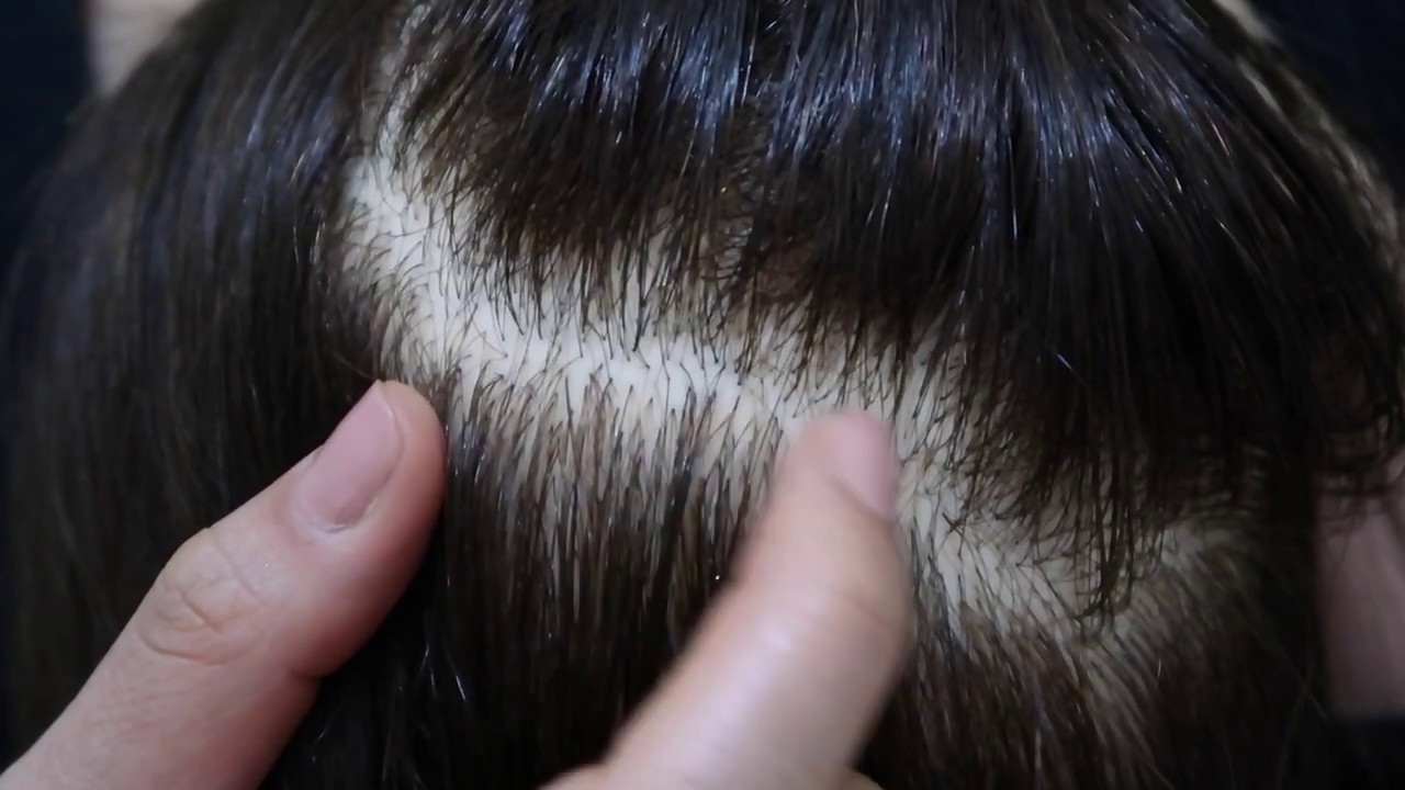 ASMR  Close Up Scalp Scratching with Nails | Oil Treatment |Stress Relief and Sleep | No talking