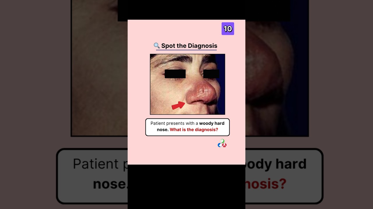 ENT Spot Diagnosis 