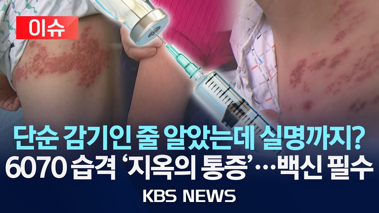 [이슈] 단순 감기인 줄 알았는데 실명까지?…6070 습격 '지옥의 통증'/2026년 2월 22일(일)/KBS