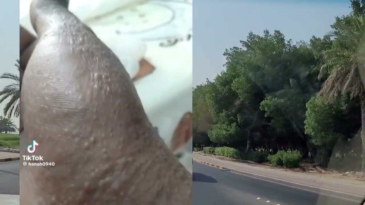 እጇን እዩ😢👆