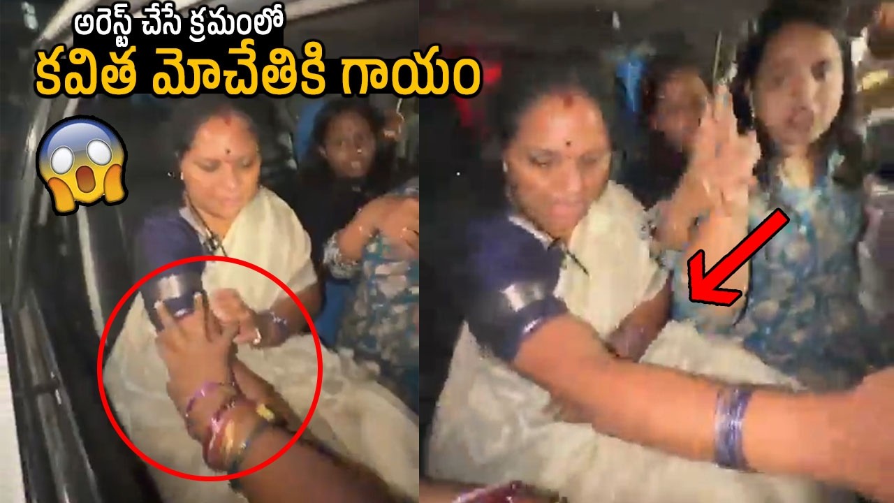 కవిత మోచేతికి గాయం | kalakuntla Kavita Got Injured While Arresting | KCR | KTR | Revanth Reddy | FC