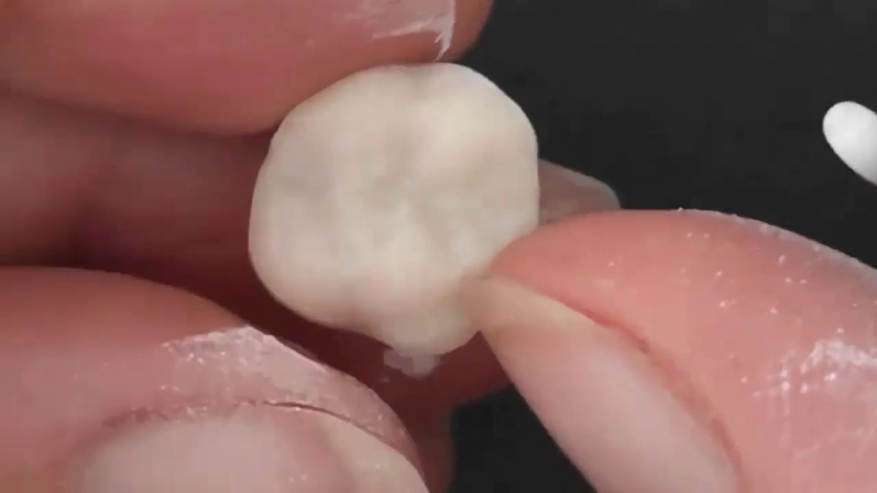 VITA ENAMIC® Tutorial | Reworking